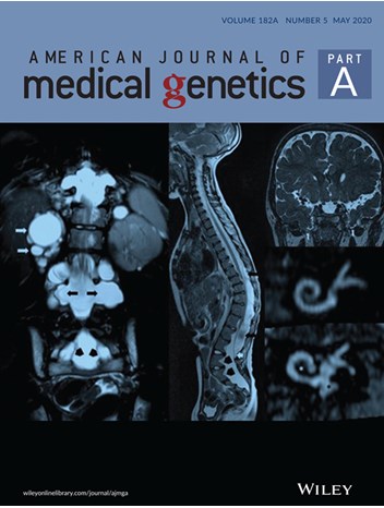 Homozygous deletion of exons 2-7 within TGFB3 gene in a child with severe Loeys-Dietz syndrome
